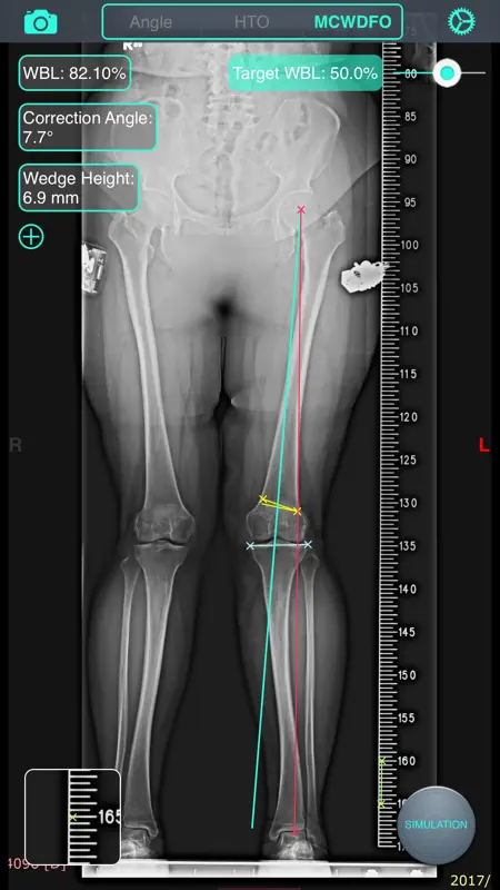 OsteoMaster screenshot 5 of 5