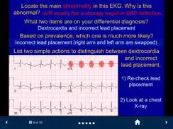 EKG - SecondLook iPad image 4