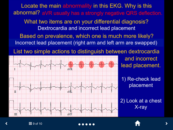 EKG - SecondLook iPad screenshot 4 - Medical app