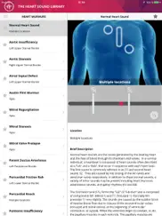 heart murmurs lite ipad images 1