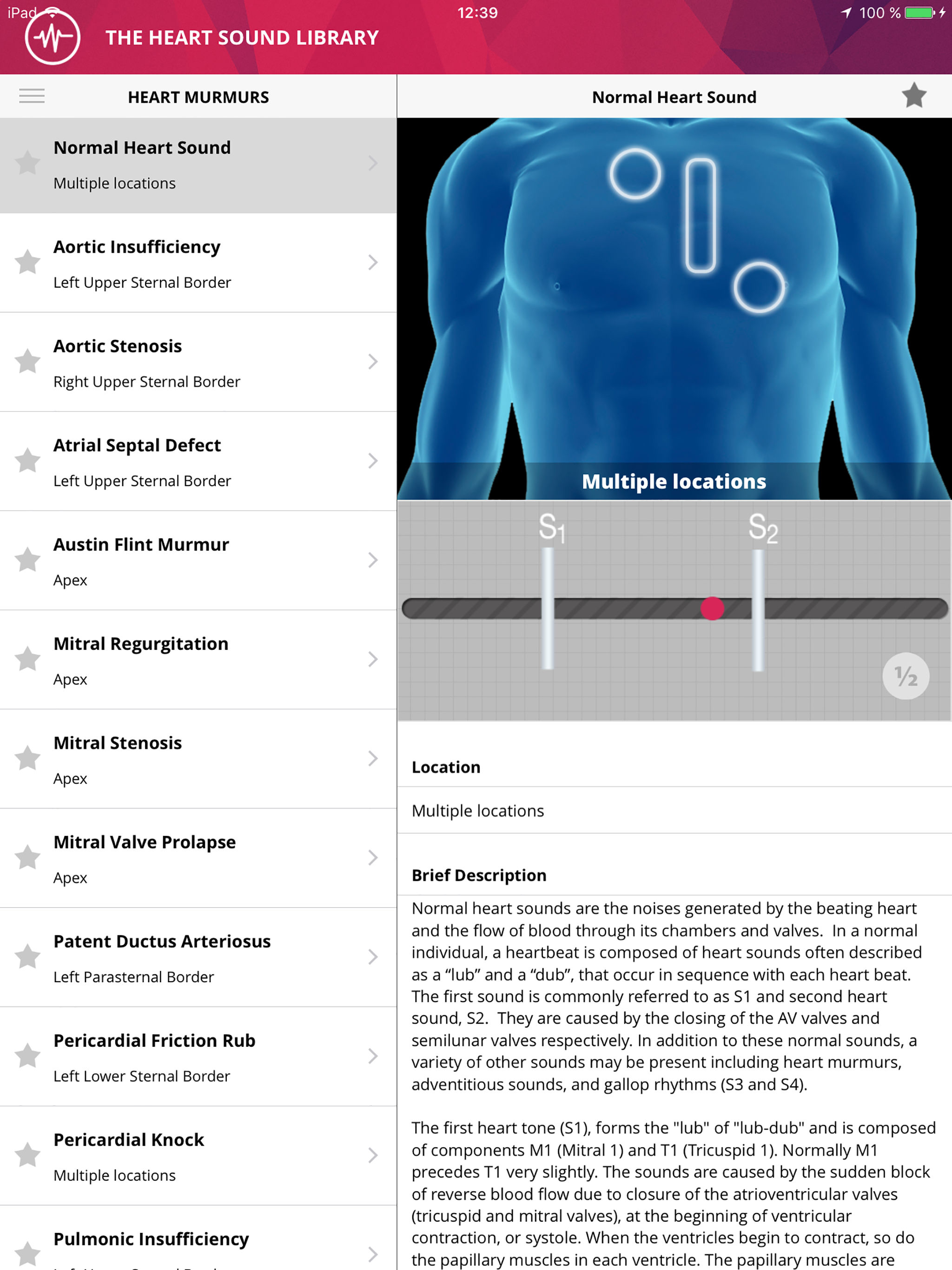 Heart Murmurs Lite screenshot 6