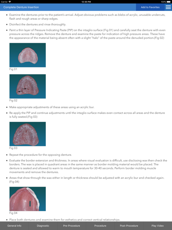 Screenshot #5 pour Dentistry ProConsult