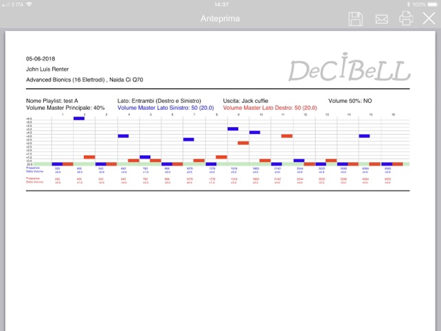 DeCiBeLL XS(圖4)-速報App