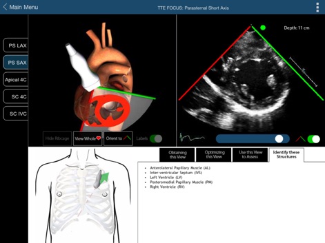 TTE FOCUS Views - Medical App | MWM