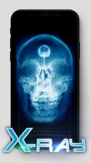 best x-ray iphone screenshot 4