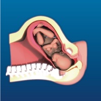 Intrapartum pour PC