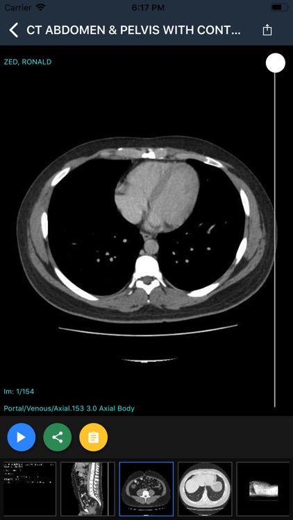 Zed Doctor SG screenshot-3