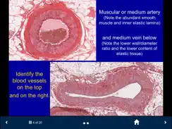 Histology Complete -SecondLook iPad image 3