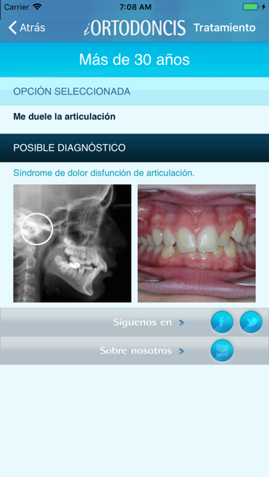 Screenshot #3 pour iOrtodoncis