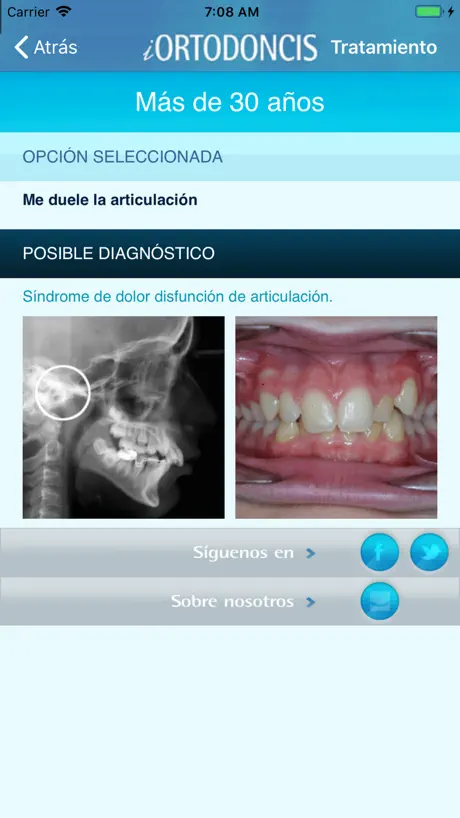 iOrtodoncis