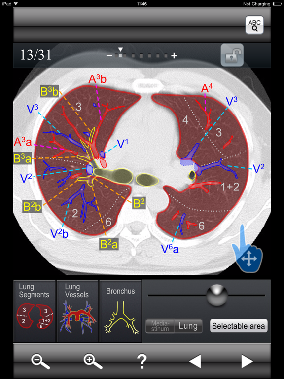 Chest CT Sectional Walkerのおすすめ画像1