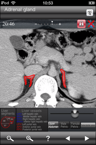 Abdominal CT Sectional Walker screenshot 4