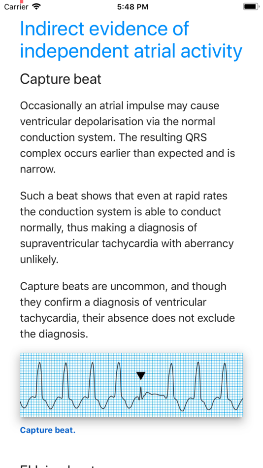 #5. ECG Basics Lite: ECG Made Easy (iOS) Bởi: Sree Hari Reddy Gadekallu