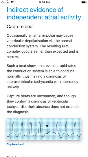 ECG Basics Lite: ECG Made Easy iPhone Screenshot 5