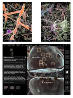 Brain & Nervous System Pro III iPad image 3