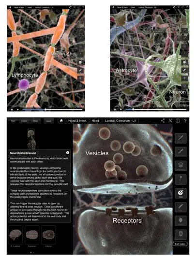 Brain & Nervous System Pro III iPhone Screenshot 3