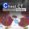 Chest CT Sectional Walker