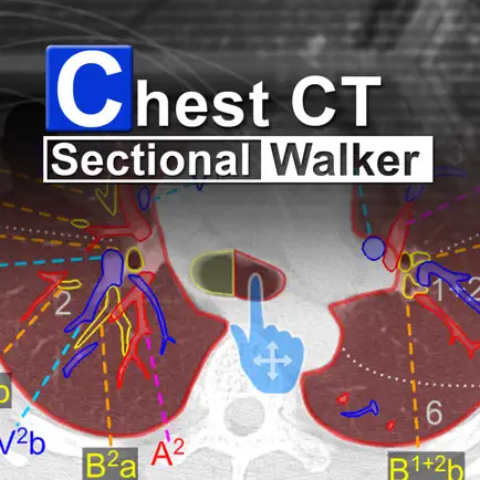 Chest CT Sectional Walker Читы