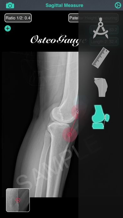 OsteoGauge - lower limb Screenshot