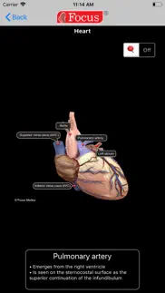How to cancel & delete heart - digital anatomy 1