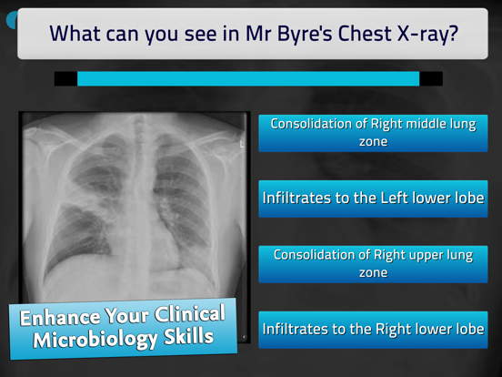 Microbiology Virtual Patients iPad screenshot 4 - Medical app