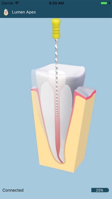 Screenshot #1 pour Lumen Apex