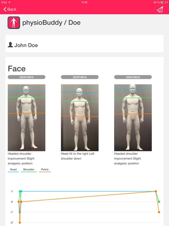 PhysioBuddy screenshot-4