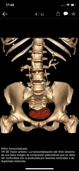 Patología 3D Urología(圖5)-速報App