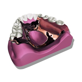 Screenshots (5) Removable Partial Dentures