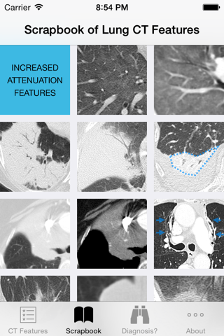 Lung CT Field Guide - náhled