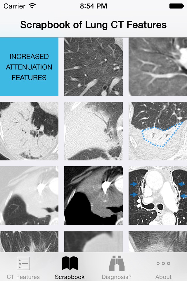 Lung CT Field Guide screenshot 3