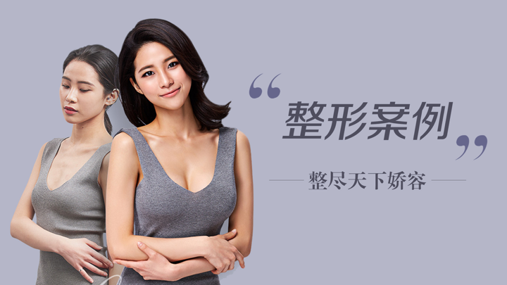 整形医生案例-美容微整形的新氧气 screenshot 1