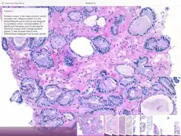 Game screenshot Hopkins Prostate Pathology hack