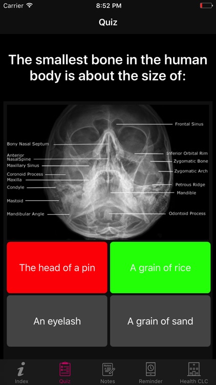 Human Anatomy Blood Facts 2000 screenshot-3