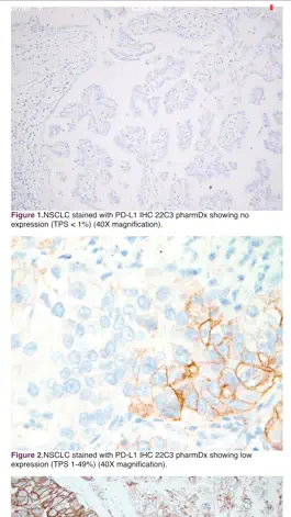 Game screenshot IASLC Atlas of PD-L1 Testing in Lung Cancer hack
