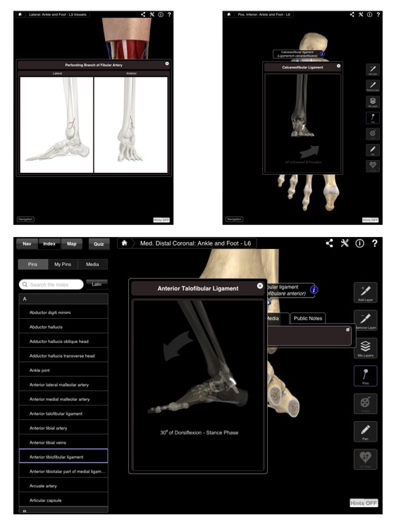 Ankle & Foot Pro III for iPad screenshot-4