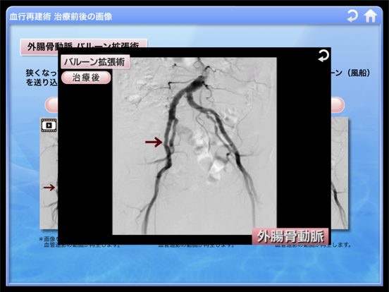 末梢動脈3Dアトラスのおすすめ画像4