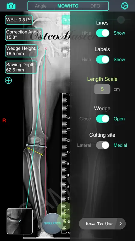 OsteoMaster screenshot 4 of 5