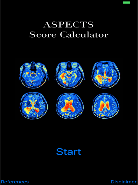 Screenshot #4 pour ASPECTS Score Calculator