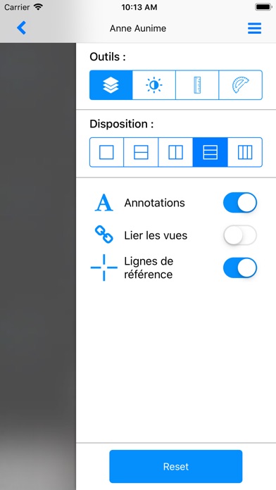 TÉLÉCHARGER LOGICIEL DICOM GRATUIT GRATUITEMENT LOGICIEL DICOM GRATUIT GRATUITEMENT