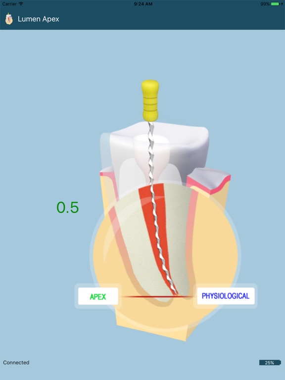 Screenshot #6 pour Lumen Apex