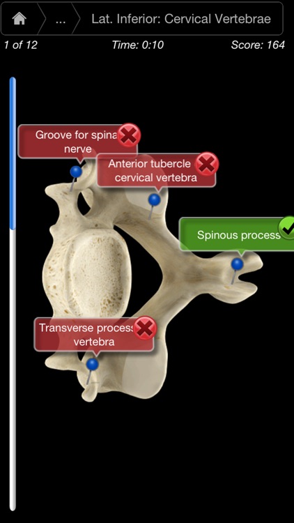 Skeleton System Pro III-iPhone screenshot-4