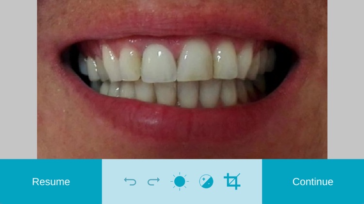 Rayplicker™ Pics App Solution