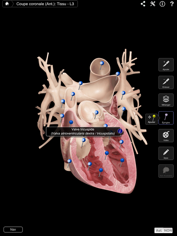 Screenshot #5 pour Heart Pro III