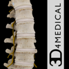 Spine Pro III - 3D4Medical from Elsevier