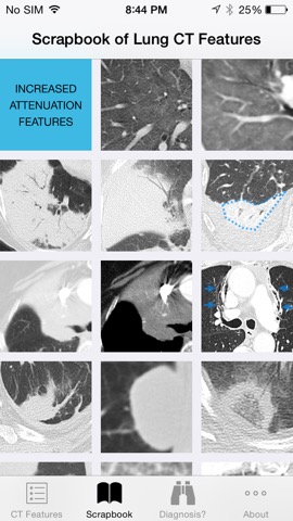 Lung CT Field Guideのおすすめ画像3