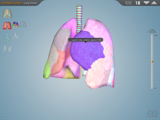 Living Lung™ - Lung Viewerのおすすめ画像3