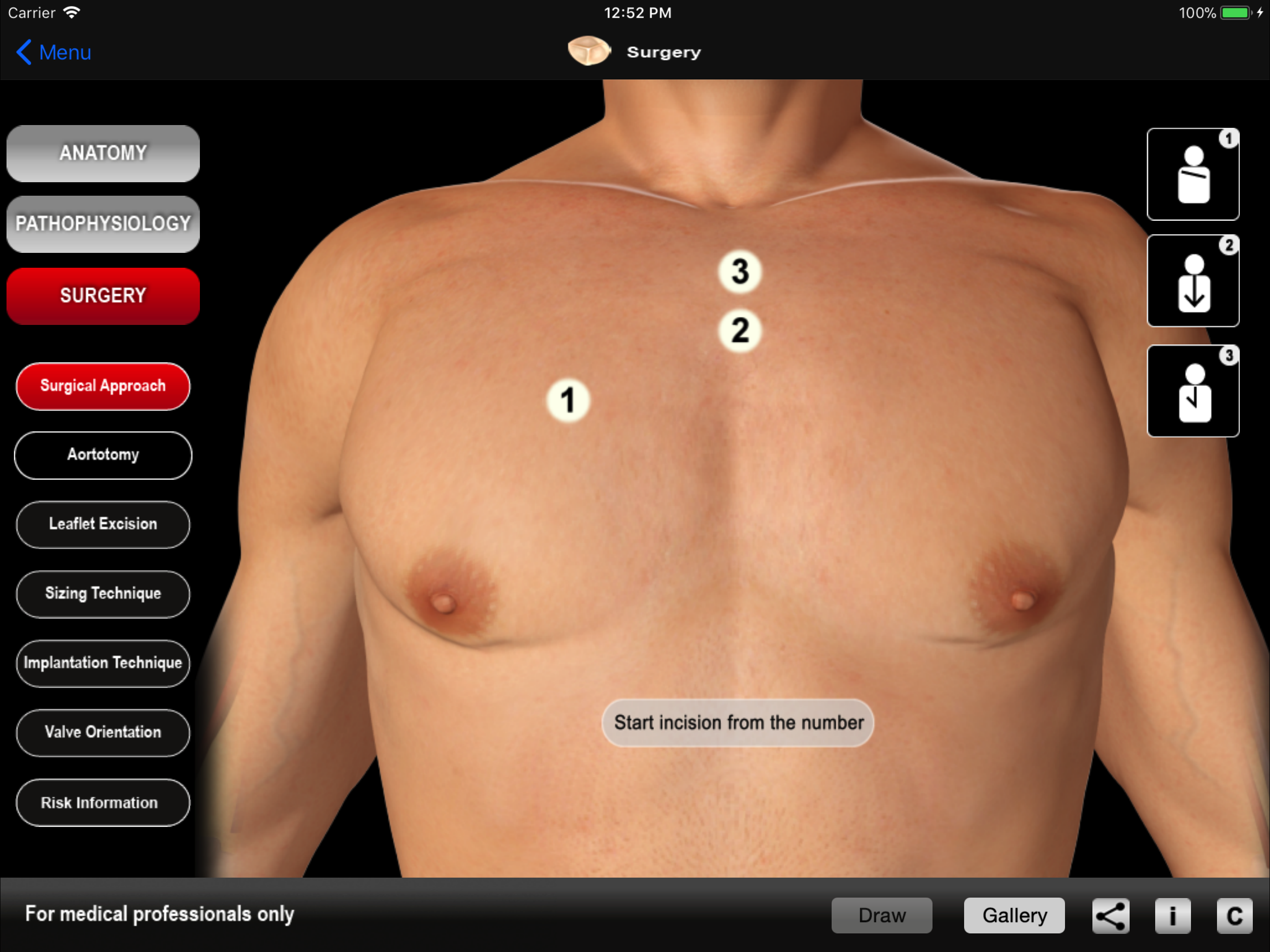 HEART MASTER Aortic Stenosis screenshot 3