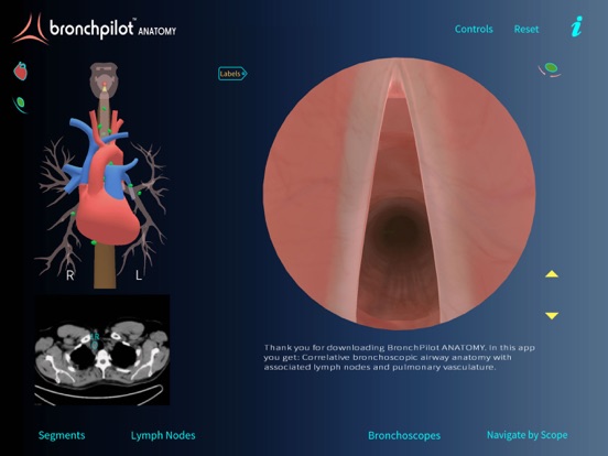 Screenshot #5 pour BronchPilot ANATOMY