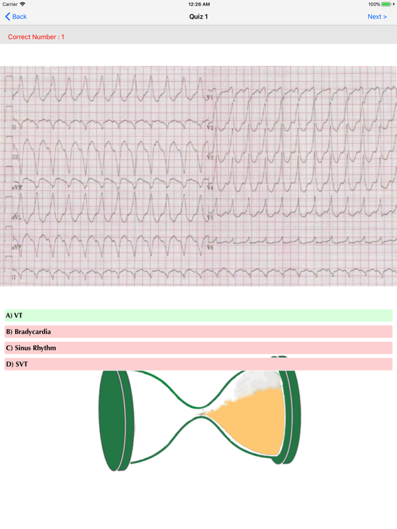Screenshot #6 pour ECG QUIZ START